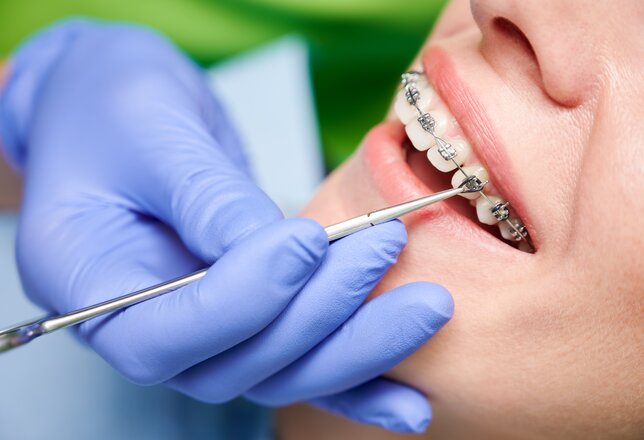 orthodontie